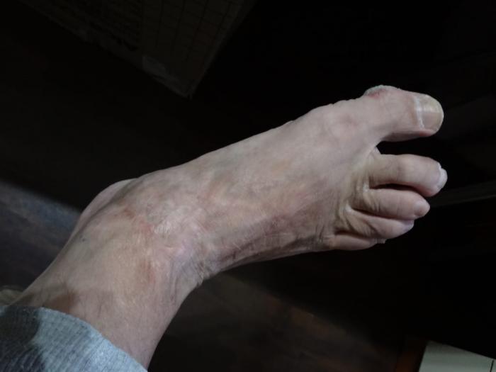 post-2428-0-18003700-1420975075_thumb.jp