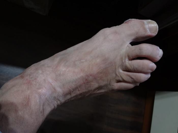 post-2428-0-63555500-1420975080_thumb.jp